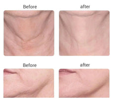 Lift & Sculpt: Micro-current Facial Toning & Lifting Beauty Device