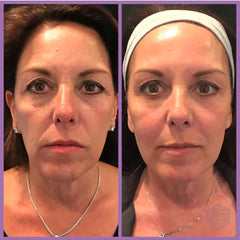 Lift & Sculpt: Micro-current Facial Toning & Lifting Beauty Device